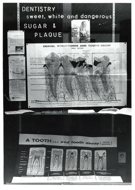 Photograph of Dentistry display case exhibit on Sugar and Plaque