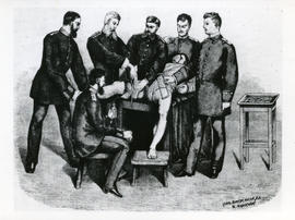 Photograph of a vintage sketch of a leg amputation